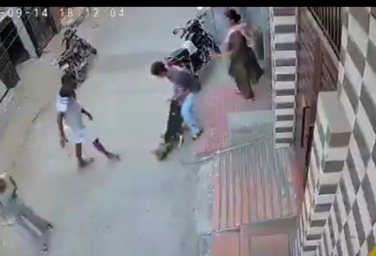 गोद में 6 महीने का मासूम, अचानक टूट पड़ा पिटबुल; सड़क पर घसीटता रहा बच्चा, CCTV में कैद घटना